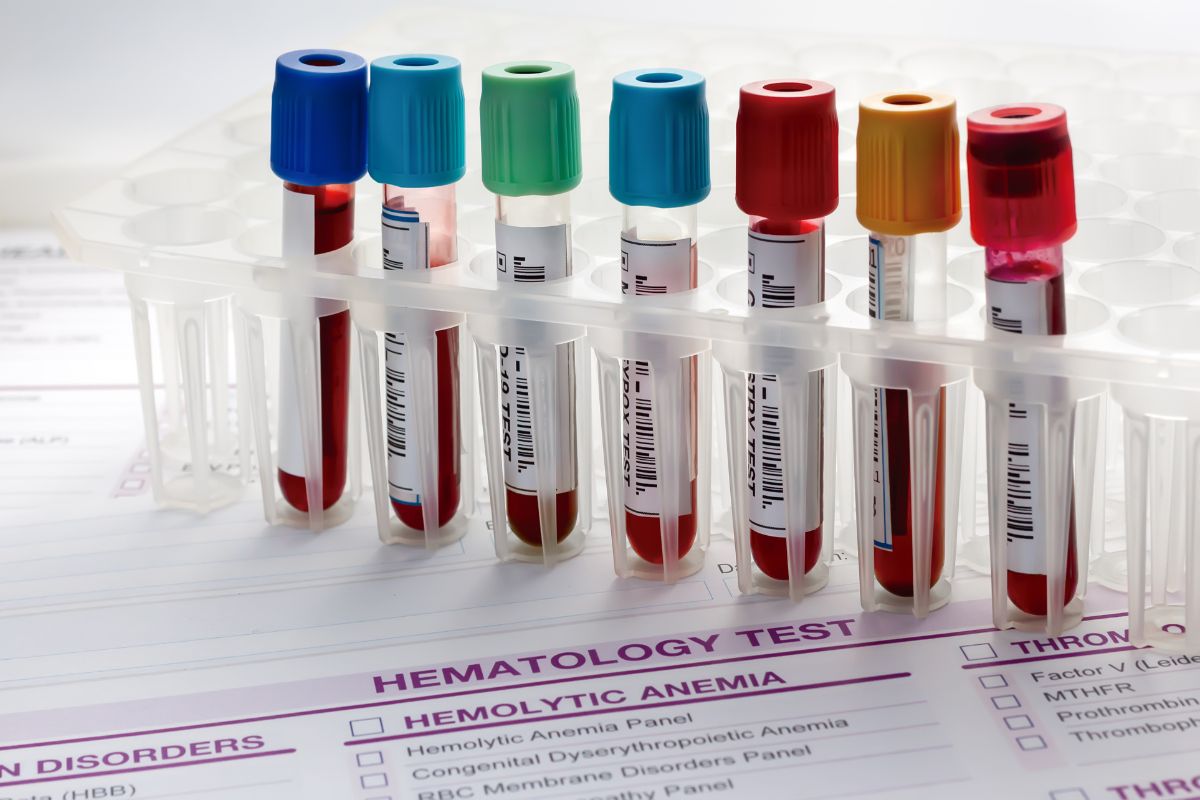 Biomarkery Bydgoszcz - diagnostyka chorób otępiennych