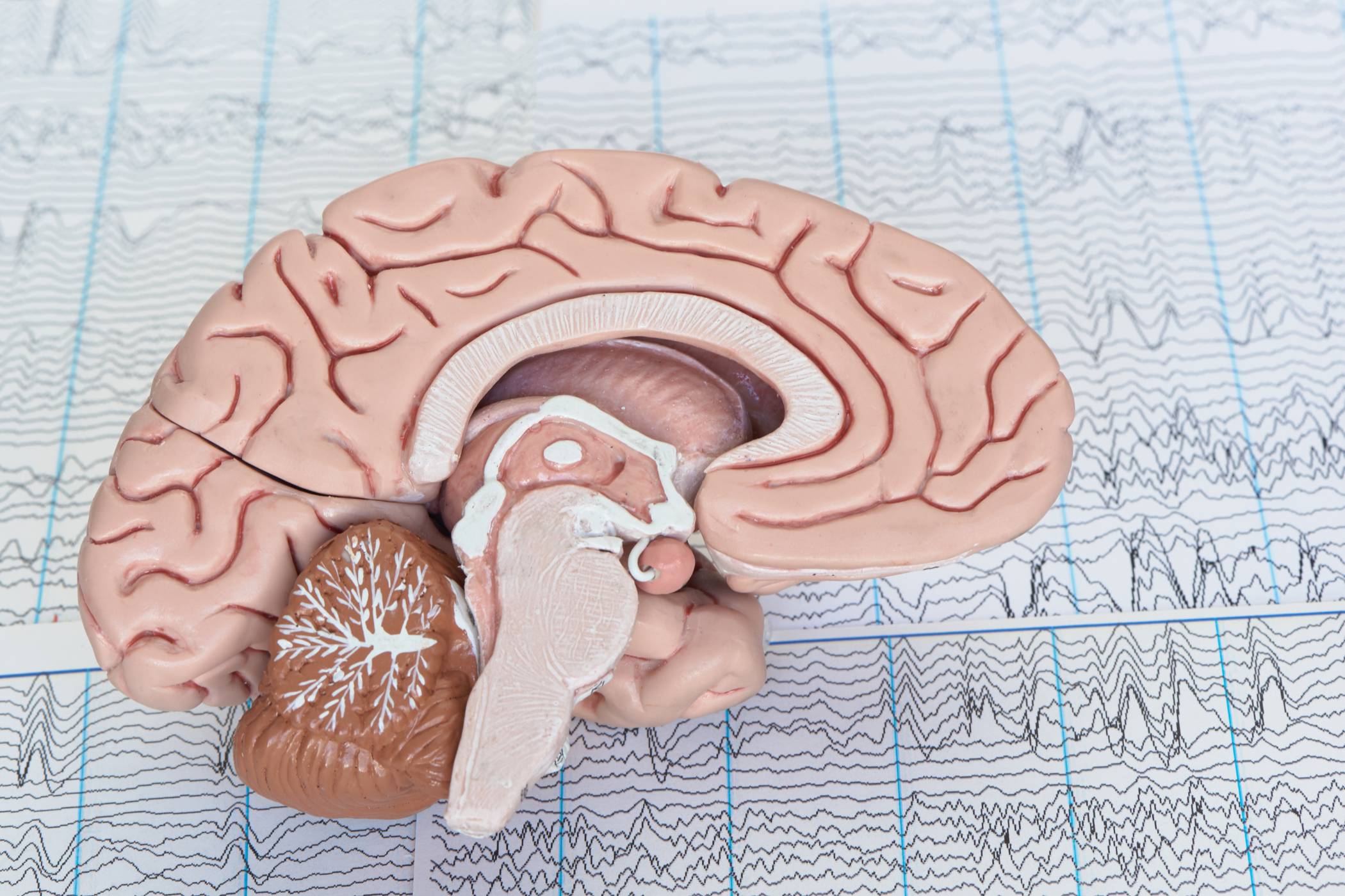 tDCS a Alzheimer i zaburzenia poznawcze