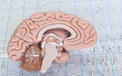 Mikropolaryzacja mózgu (tDCS) a choroba Alzheimera i łagodne zaburzenia poznawcze